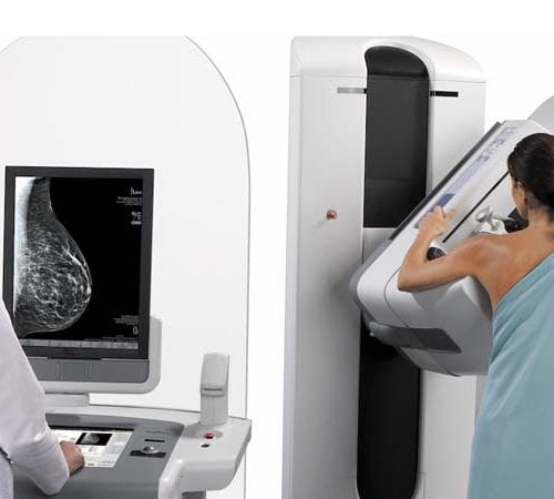 Dijital Mamografi