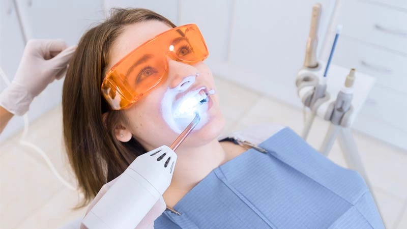 Diş lekesi tedavisi