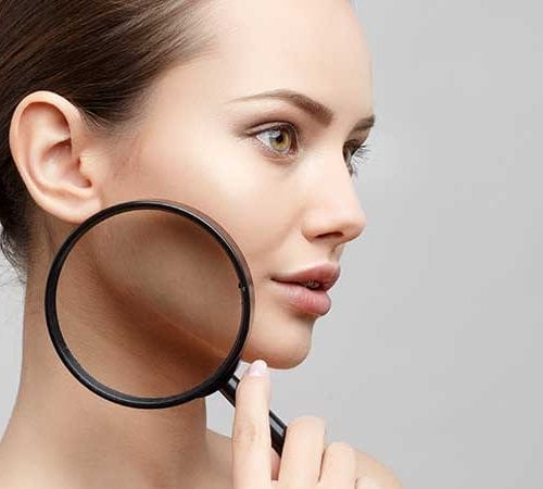 Dermatolojik Cerrahi