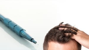 Safir Perkutan Saç Ekimi