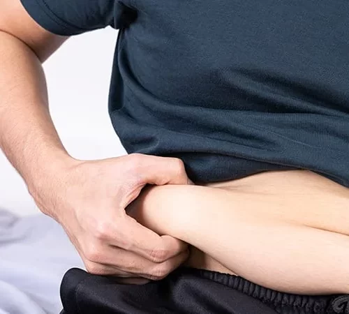 Duodenal Switch | Süper Obezite Cerrahisi