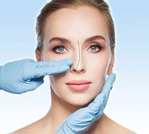 burun-egriligi-m burun eğriliği olan kadın