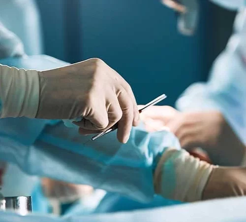 Hemoroid Ameliyatı (Basur Ameliyatı)