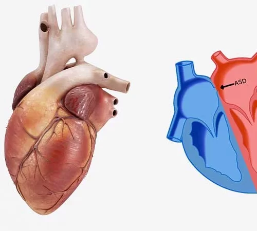 kalp-deligi-m kalp deliği görseli