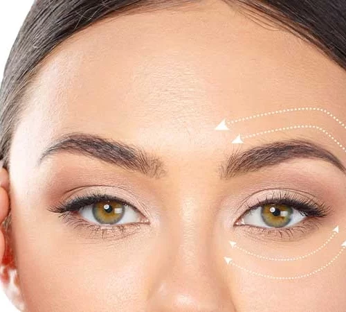 goz-estetigi-m göz estetiği muayenesi