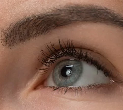 goz-onunde-ucusan-cisimler-m Gözde Sinek Uçuşması kadın gözü