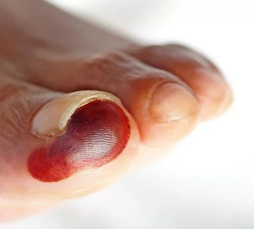 kangren-e Kangren Olan Ayak