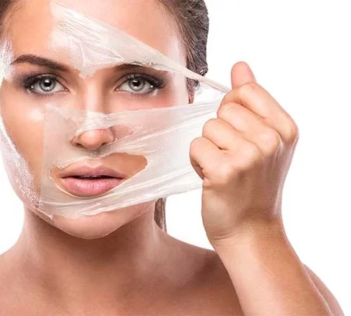 kimyasal-peeling-e Kimyasal Peeling Sonrası