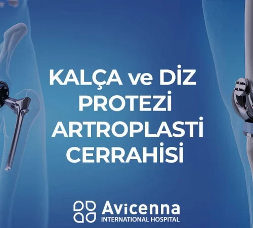 Kalça ve diz protezi artroplasti cerrahisi
