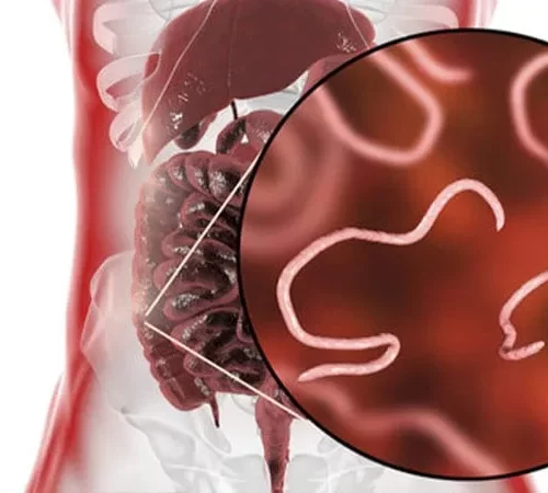 kil-kurdu-m Kıl Kurdu (Bağırsak Kurdu) görünümü