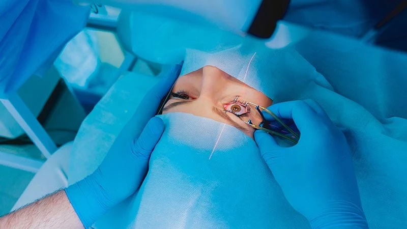 Lasik Lazer Göz Ameliyatı