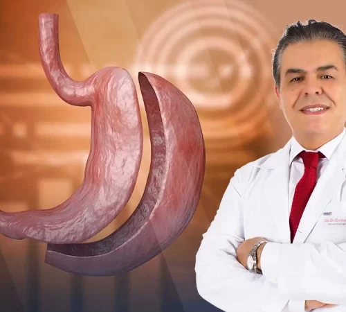 Obezite (Şişmanlık) Tedavi Yöntemleri