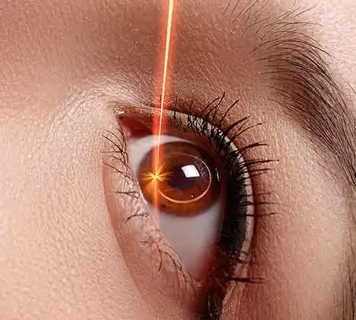 prk-lazer-goz-ameliyati-e PRK Lazer Göz Ameliyatı