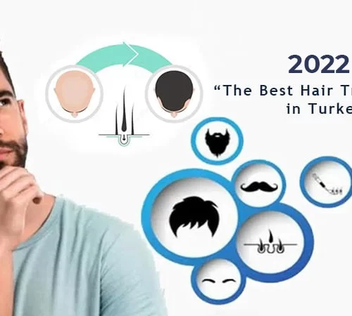 2022 The Best Hair Transplant in Turkey