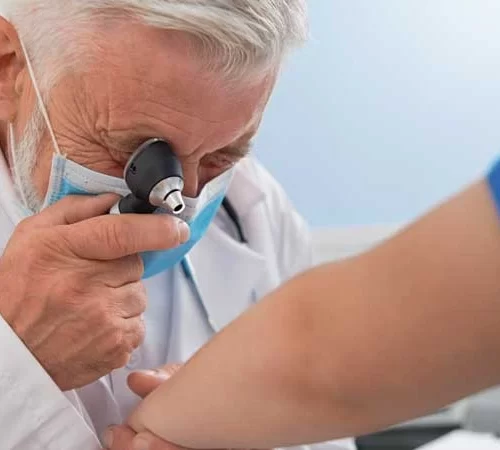 behçet hastalığı tanısı için cilt kontrolü yapan doktor