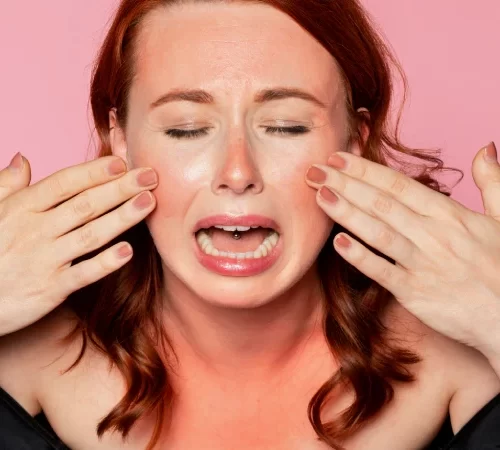 Güneş alerjisi olan kadın