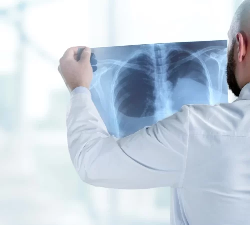 Kemik kanseri muayenesi