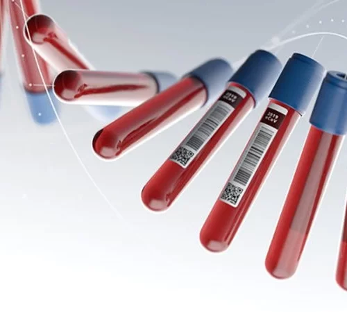 HIV (AIDS)