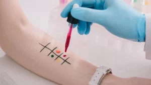Alerji ve İmmunoloji hastalıkları için alerji testi