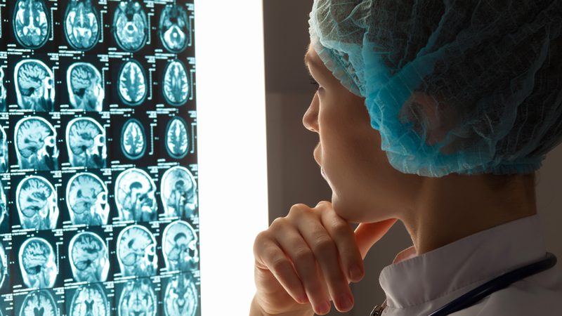 Beyin ve Sinir Cerrahisi Hastalıkları Tanısı