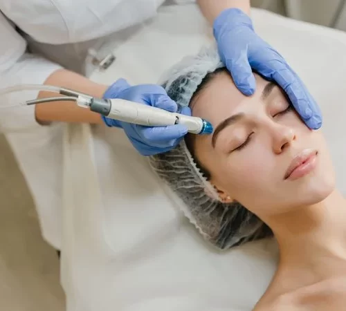 dermapen tedavisi uygulanan kadın
