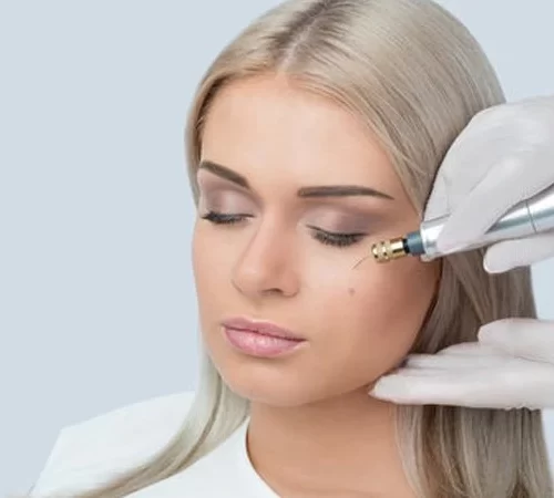fibroblast tedavisi yapılan kadın