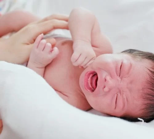 gastrosizis-e Gastroşizis sorunu olan bebek