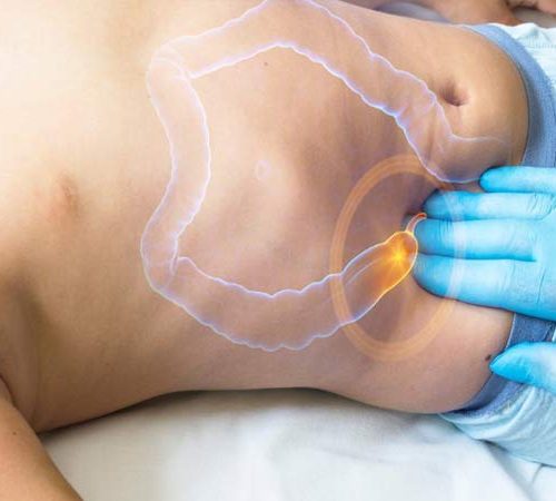 What Should You Pay Attention To After Appendix Removal Surgery?