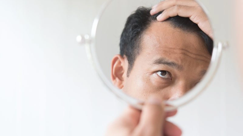 saç ekimi operasyonu riskleri aynada saçına bakan adam