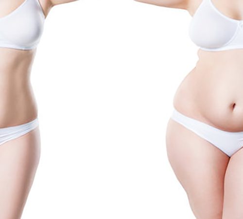 bariatric surgery before and after