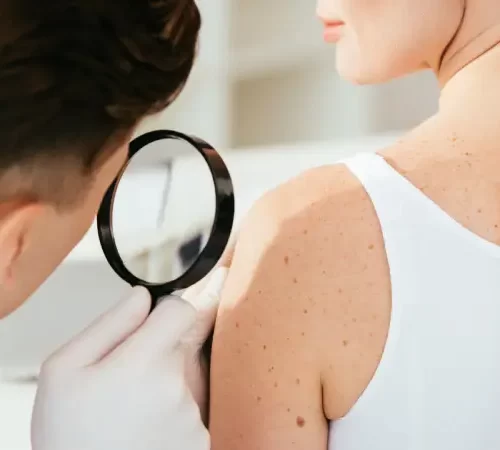 cilt-hastaliklari-m cilt hastalıkları dermatolojik muayene