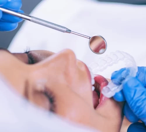 dis-sikma-m diş sıkma (bruksizm) ve diş gıcırdatma aparatı