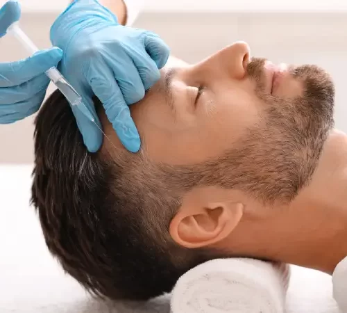 otolog-mikro-greft-m Otolog Mikro Greft uygulanan erkek hasta