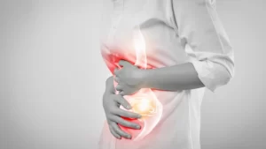 Gastrointestinal cerrahi öncesi karın ağrısı yaşayan kadın hasta