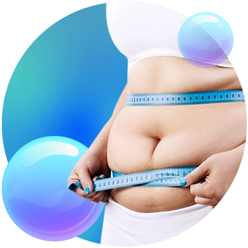 Befor Bariatric Surgery