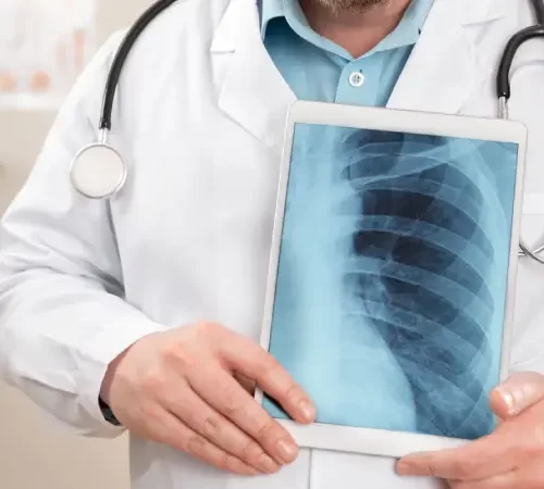 plörezi akciğer grafisi tutan doktor