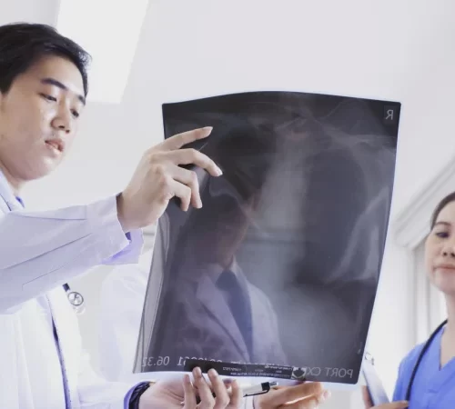 akciğerlerde pulmoner emboli röntgeni inceleyen doktorlar