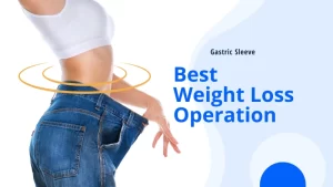 best weight loss operation Gastric Sleeve surgery