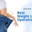 Best Weight Loss Operation: Gastric Sleeve
