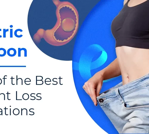 Gastric Balloon-surgery