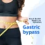 Gastric bypass: One of the Best Weight Loss Operations