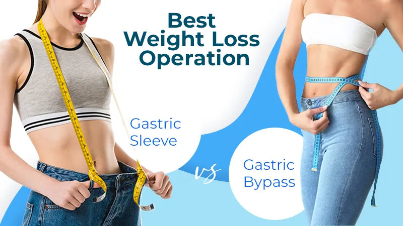 Gastric Sleeve VS Gastric Bypass