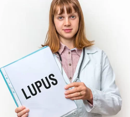 lupus hastalığı yazısı tutan önlüklü kız