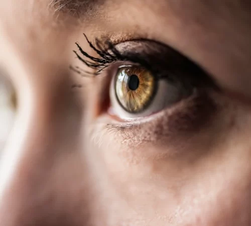 nistagmus hastalığı olan ela gözlü kadın