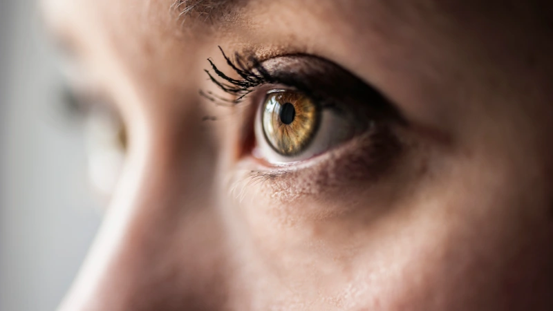 nistagmus hastalığı olan ela gözlü kadın