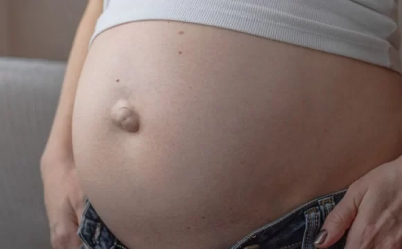 Hamilelikte göbek fıtığı sorunu yaşayan kadın