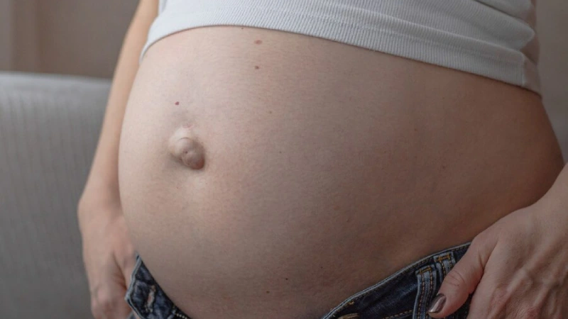 Hamilelikte göbek fıtığı sorunu yaşayan kadın