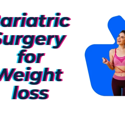 Bariatric Surgery