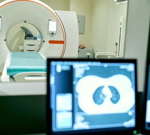 Bilgisayarlı tomografik anjiyografi işlem odası