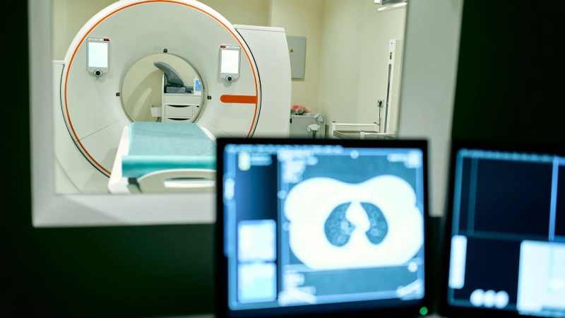Bilgisayarlı tomografik anjiyografi işlem odası